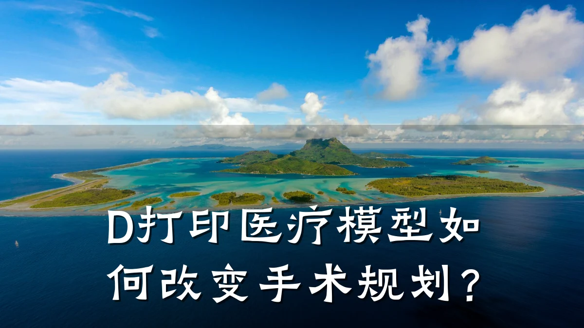 D打印医疗模型如何改变手术规划?